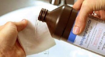Acqua ossigenata, 3 problemi che puoi risolvere: mai più senza