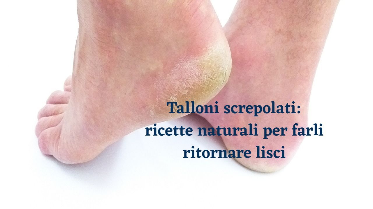 talloni screpolati ricette naturali lisci