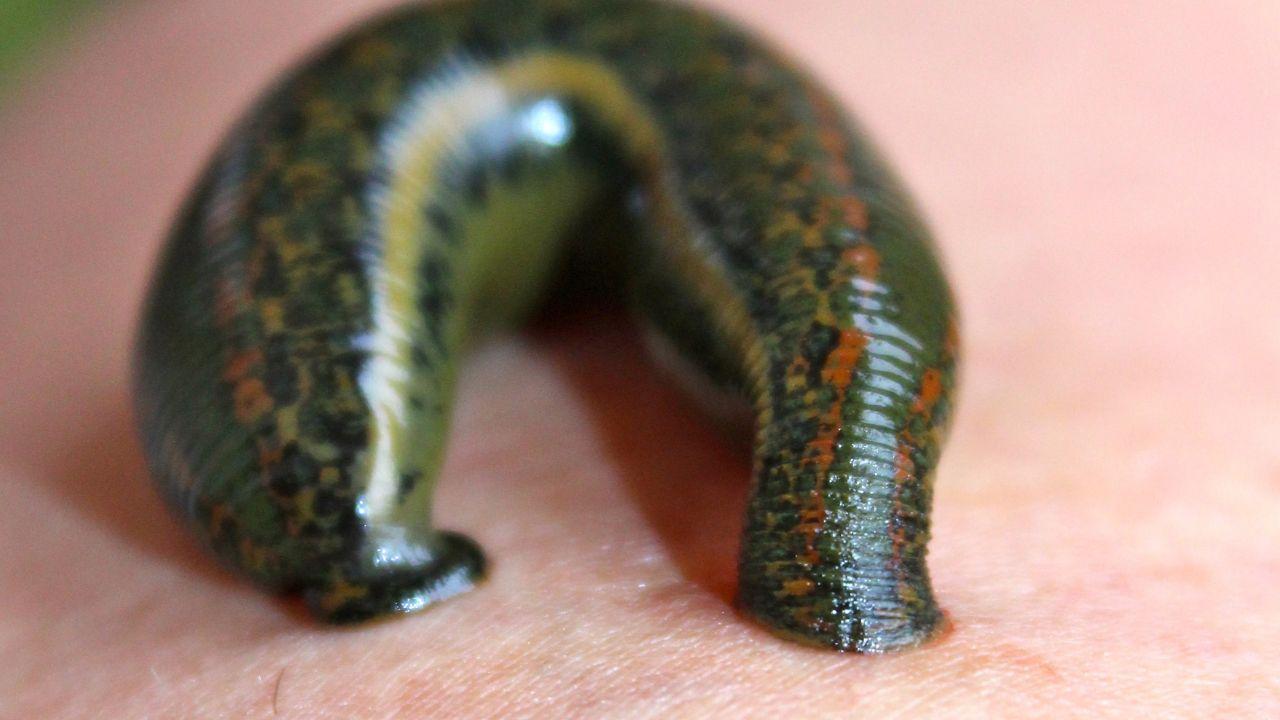 Sanguisuga gigante attaca uomo dove è