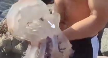 Tocca un’enorme medusa, le conseguenze sono dolorosissime