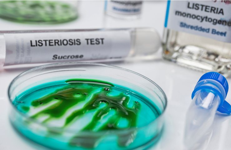 Test batterio listeria